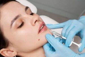 how long a dermal filler treatment last